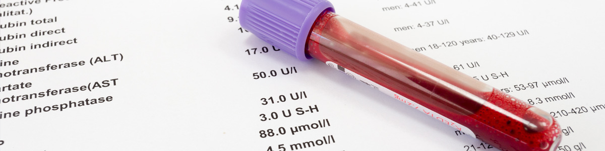 Blood Tests Photo